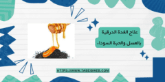علاج الغدة الدرقية بالعسل والحبة السوداء