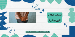 اسباب حرقان البول والبراز