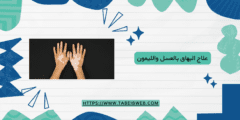 علاج البهاق بالعسل والليمون