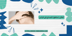 أماكن (مناطق) الصداع في الرأس