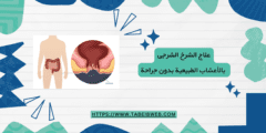 علاج الشرخ الشرجى بالأعشاب الطبيعية بدون جراحة