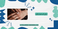 علاج الصدفية بالخل