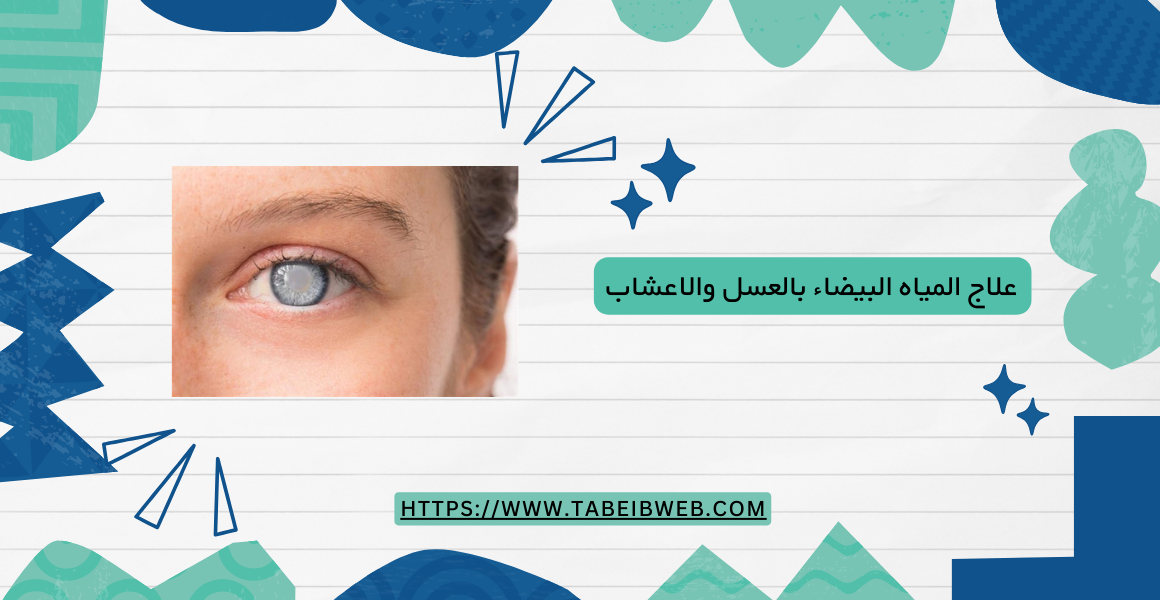علاج المياه البيضاء بالعسل والاعشاب