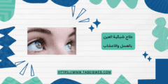 علاج شبكية العين بالعسل والاعشاب