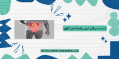 أسباب حرقان البول وألم أسفل الظهر عند النساء والرجال