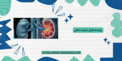 روشتة لعلاج حصوات الكلى