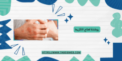 روشتة لعلاج الاكزيما
