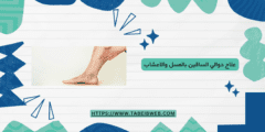 علاج دوالي الساقين بالعسل والاعشاب