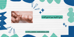 علاج الاكزيما بين أصابع القدم