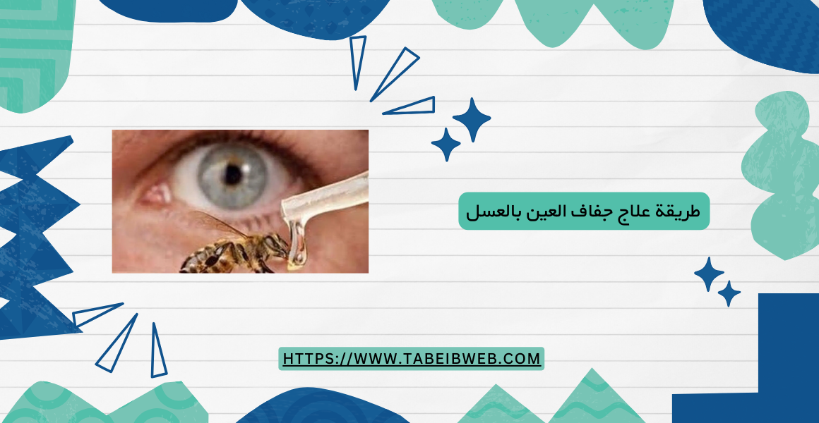 طريقة علاج جفاف العين بالعسل