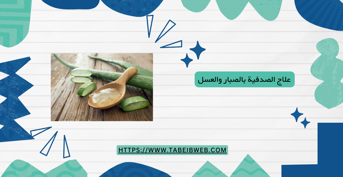 علاج الصدفية بالصبار والعسل