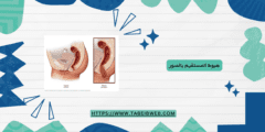 هبوط المستقيم بالصور
