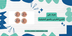 تعرف على الشرخ الشرجى بالصور الحقيقية