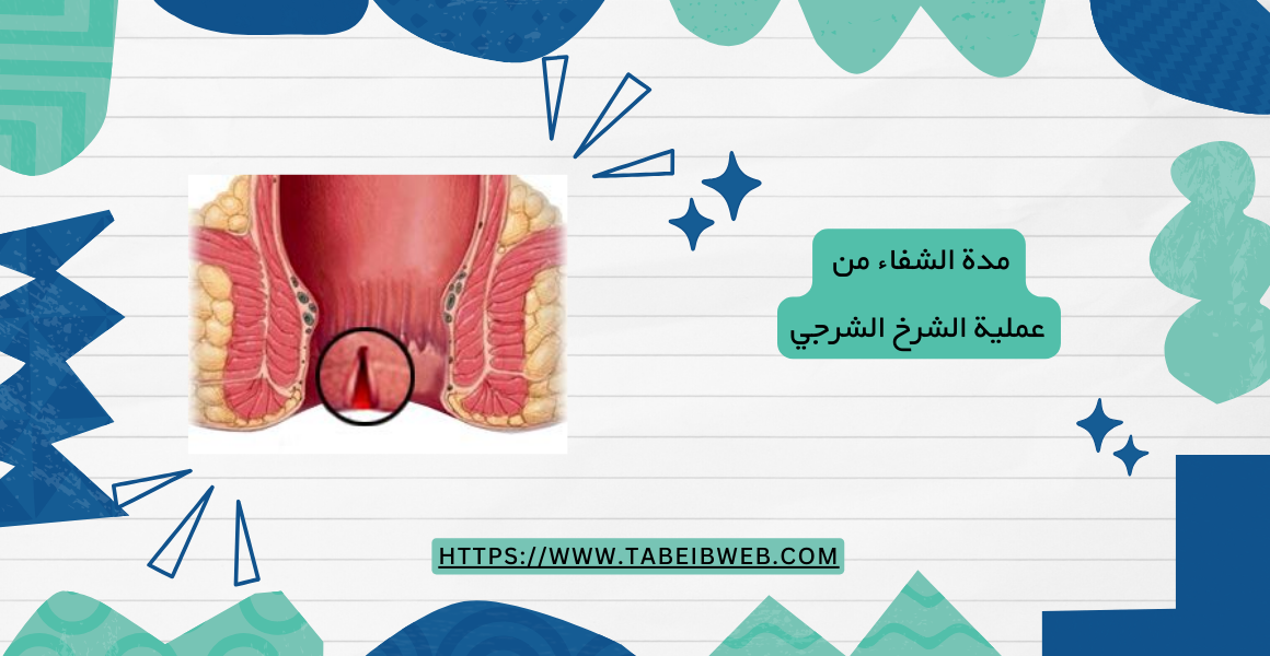 مدة الشفاء من عملية الشرخ الشرجي