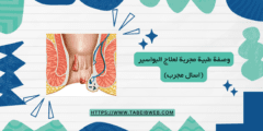 وصفة طبية مجربة لعلاج البواسير (اسال مجرب)