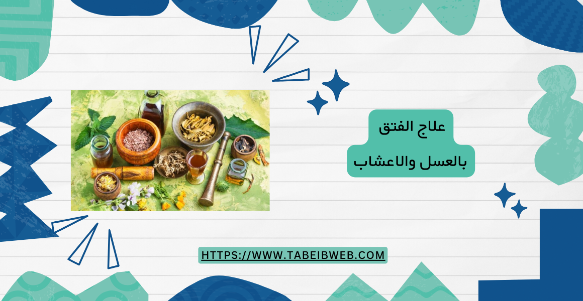 علاج الفتق بالعسل والاعشاب