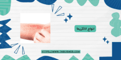 انواع الاكزيما بالصور