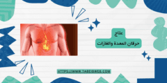 علاج حرقان المعدة والغازات