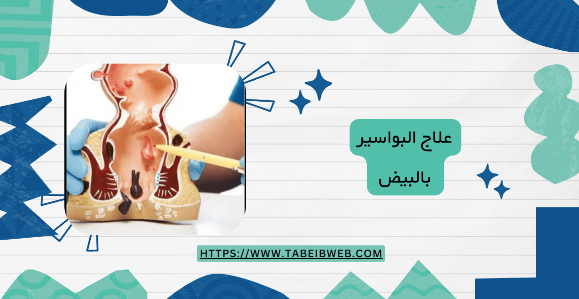 علاج البواسير بالبيض