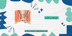 علاج البواسير بالشبت (زيت الشبت للبواسير)