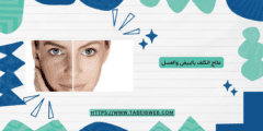 علاج الكلف بالبيض والعسل