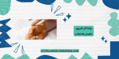 إزالة آثار الحروق بالعسل والاعشاب