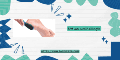 علاج تشقق القدمين بطرق فعالة