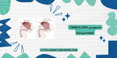 تامسولوسين Tamsulosin لتضخم البروستاتا الجرعات والمحاذير