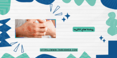 روشتة لعلاج الاكزيما
