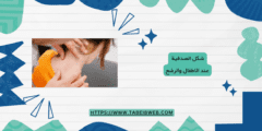 شكل الصدفية عند الاطفال والرضع