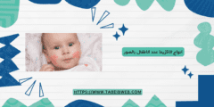 انواع الاكزيما عند الاطفال بالصور