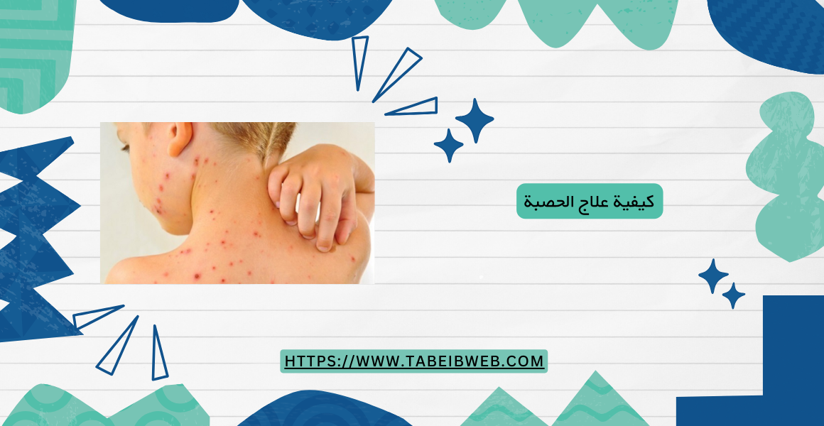 كيفية علاج الحصبة