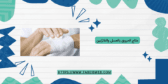 علاج الحروق بالعسل والفازلين