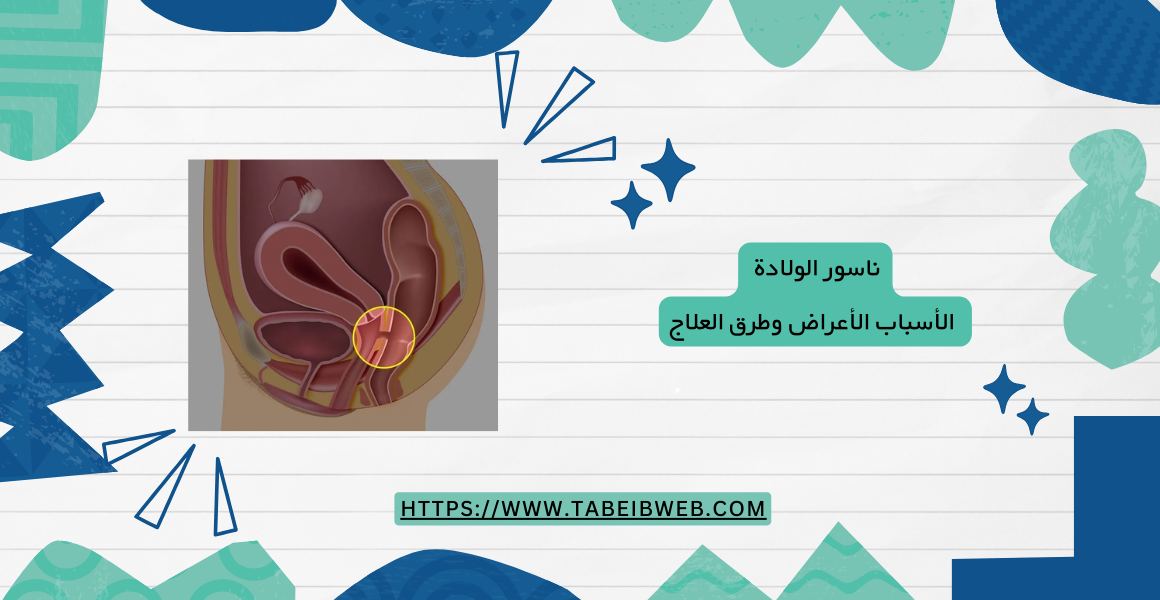 ناسور الولادة