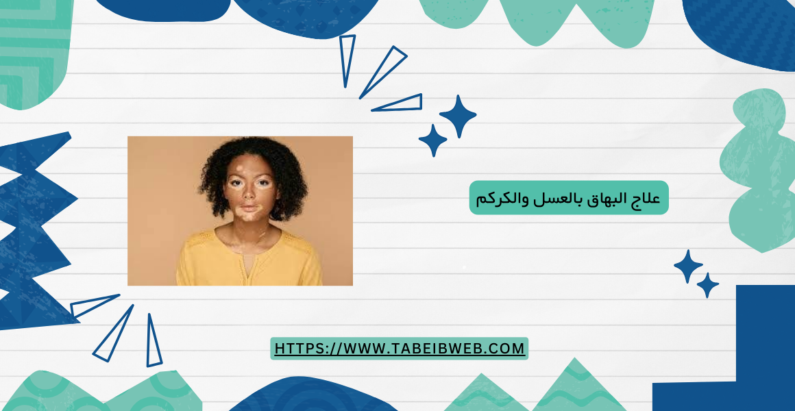 علاج البهاق بالعسل والكركم