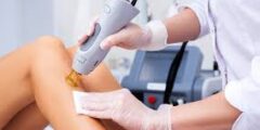 أفضل مراكز إزالة الشعر بالليزر